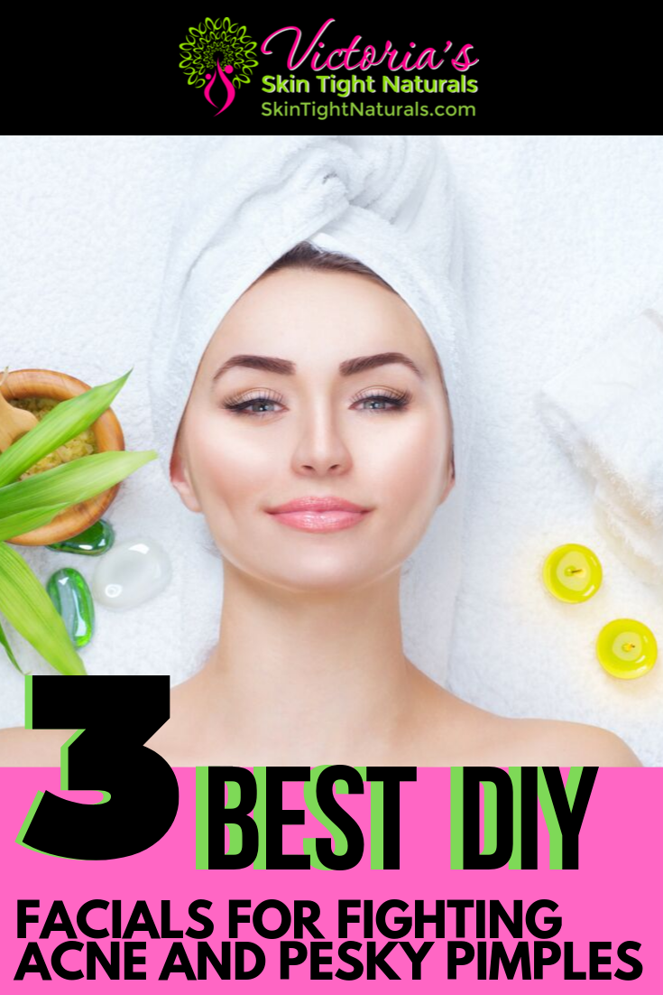 3 Best Facials for Fighting Acne & Pesky Pimples