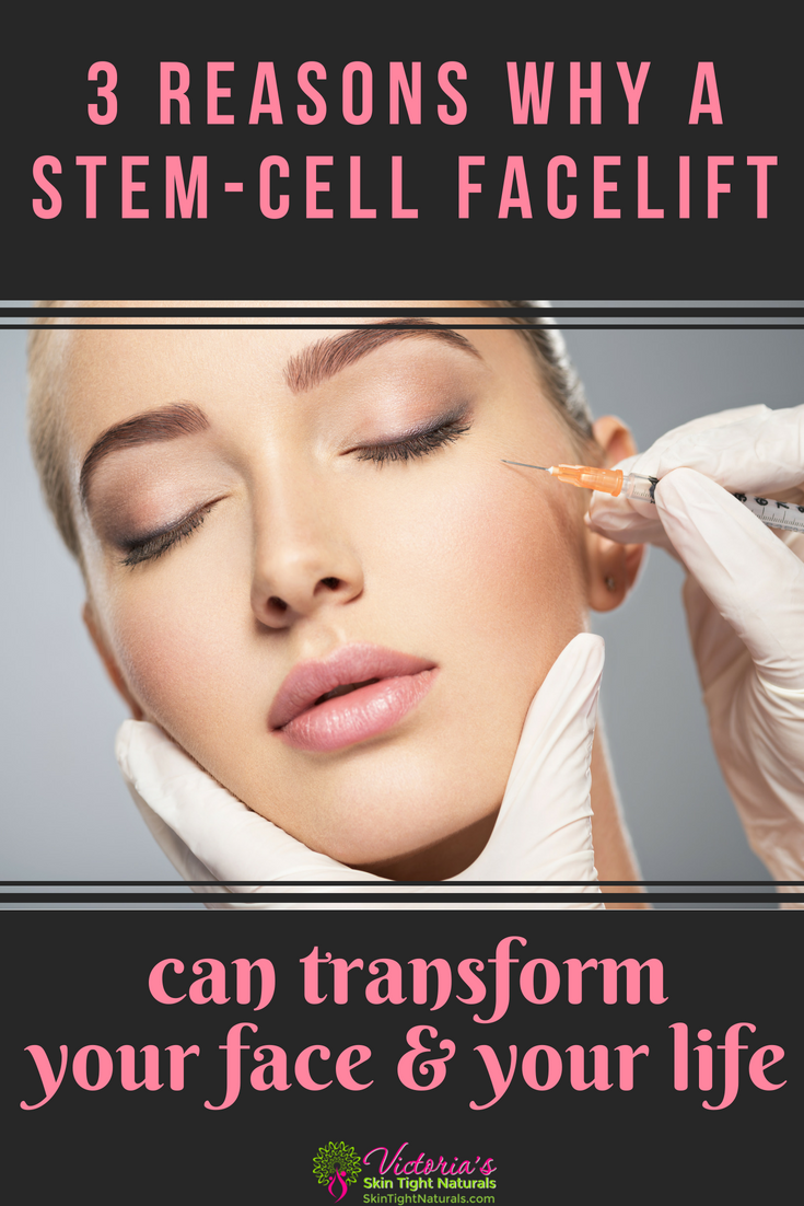 Stem Cell Facelift