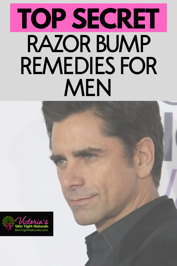 Razor Bump Remedies For Men