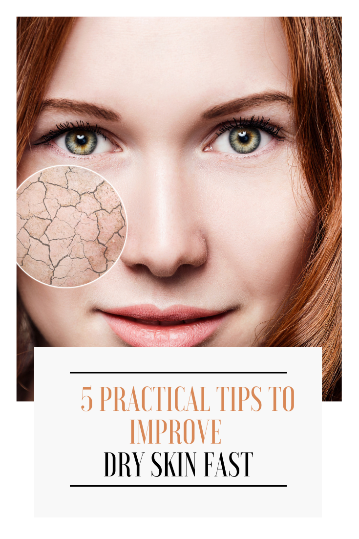 5 Tips to Improve Dry Skin