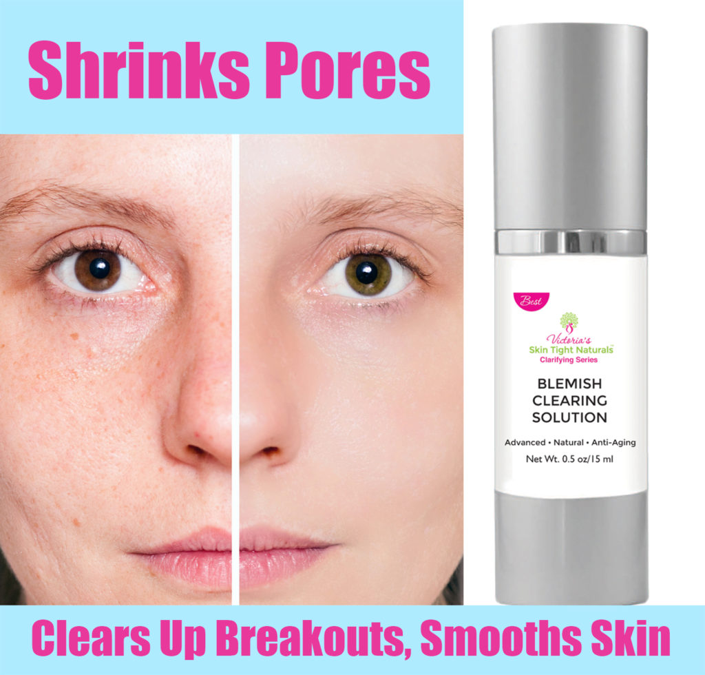 Blemish Clearing Solution