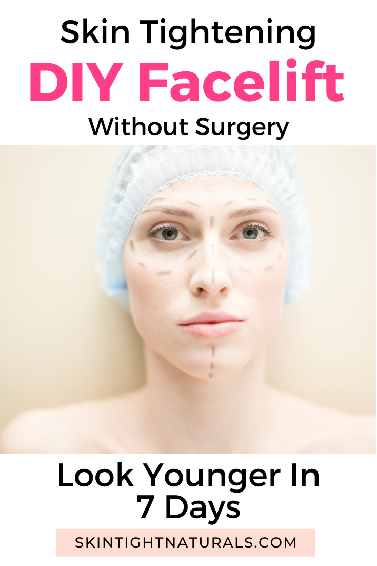 Skin Tightening DIY Facelift Without Surgery