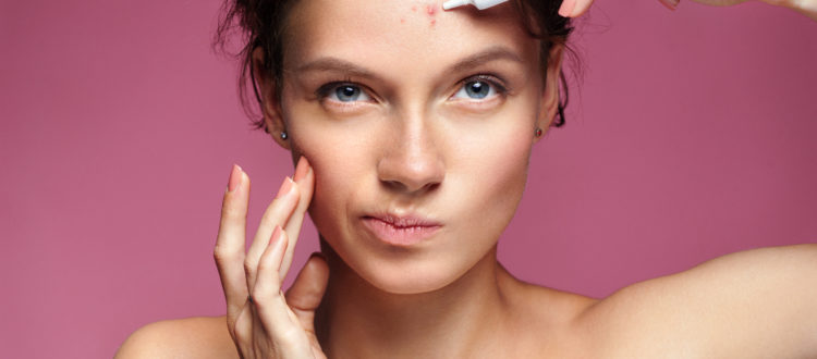 Cystic Acne: How To Get Rid Of It