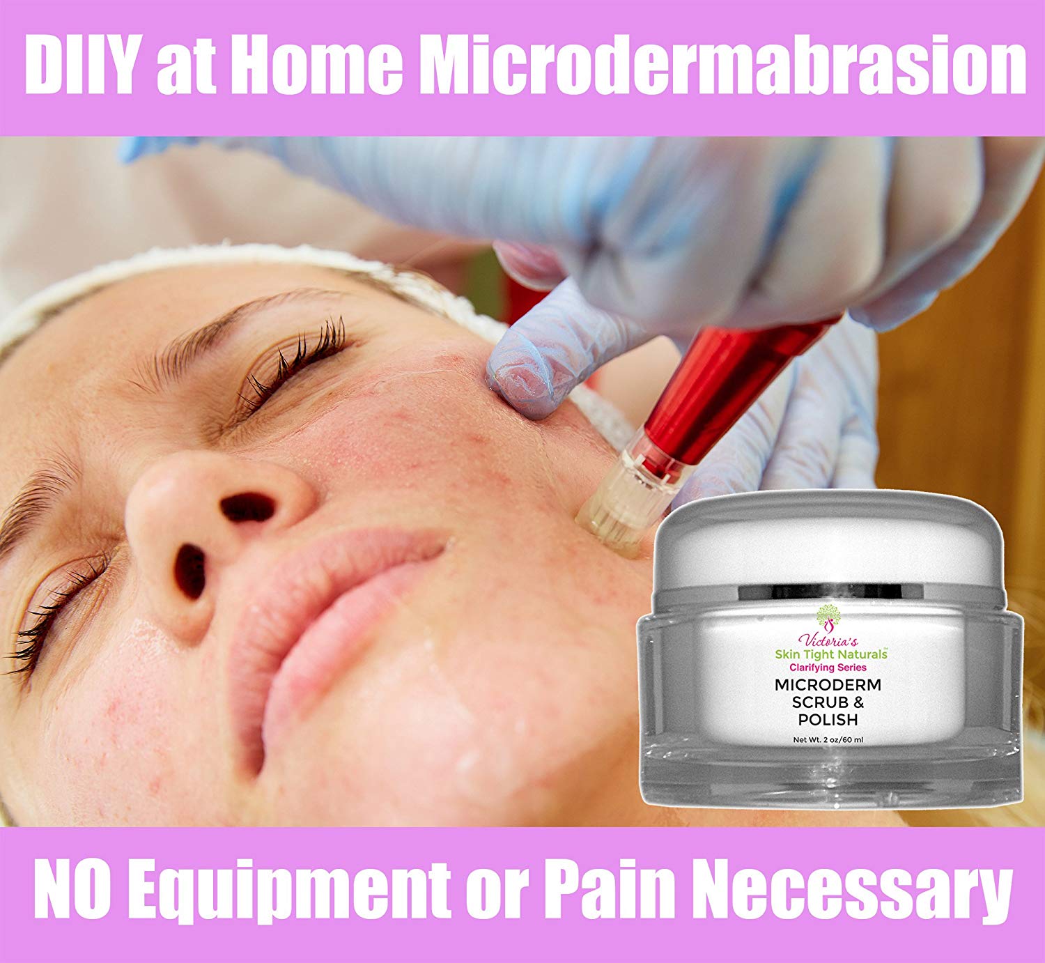 Microdermabrasion At Home
