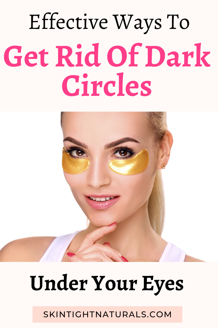 Why Do I Have Dark Circles Under My Eyes?
