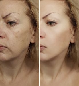 3 Aging Skin Conditions Solved
