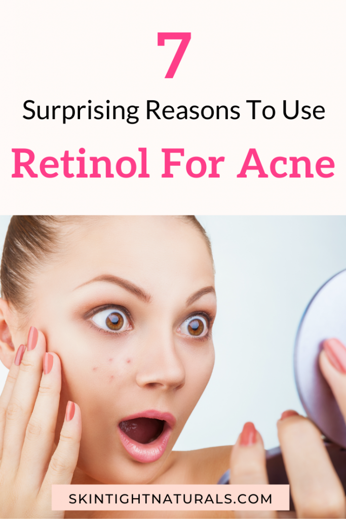 Retinol For Acne