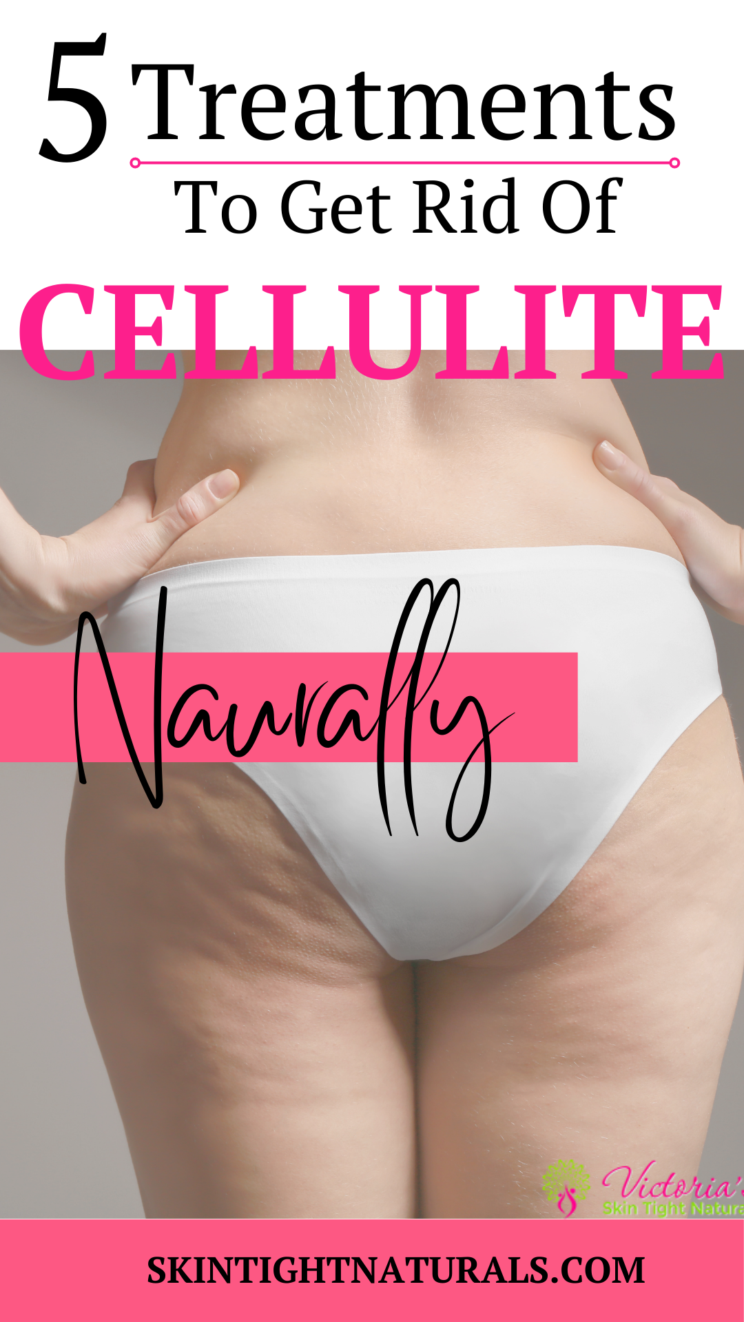5 Popular Cellulite Treatments You May Want To Check Out