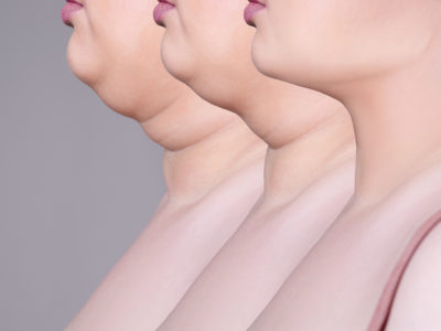 Tighten The Skin On Your Face Neck And Shoulders