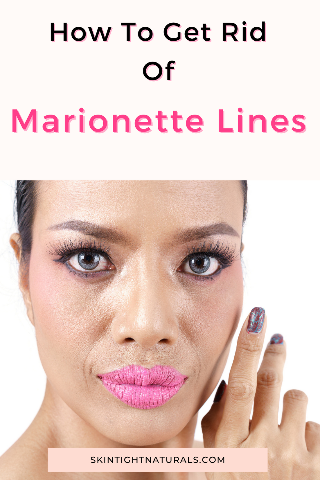 How To Get Rid Of Marionette Lines