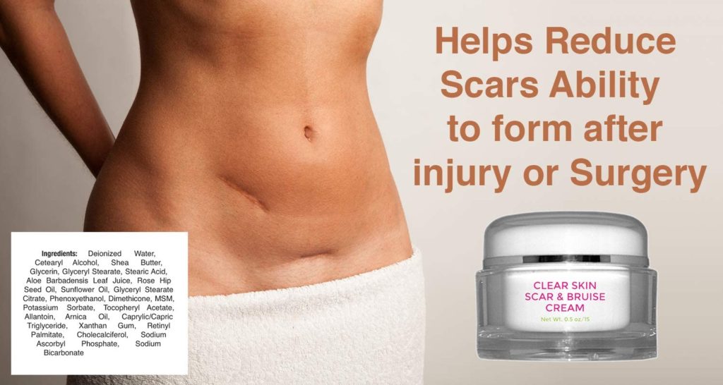 How To Fade Scars Naturally