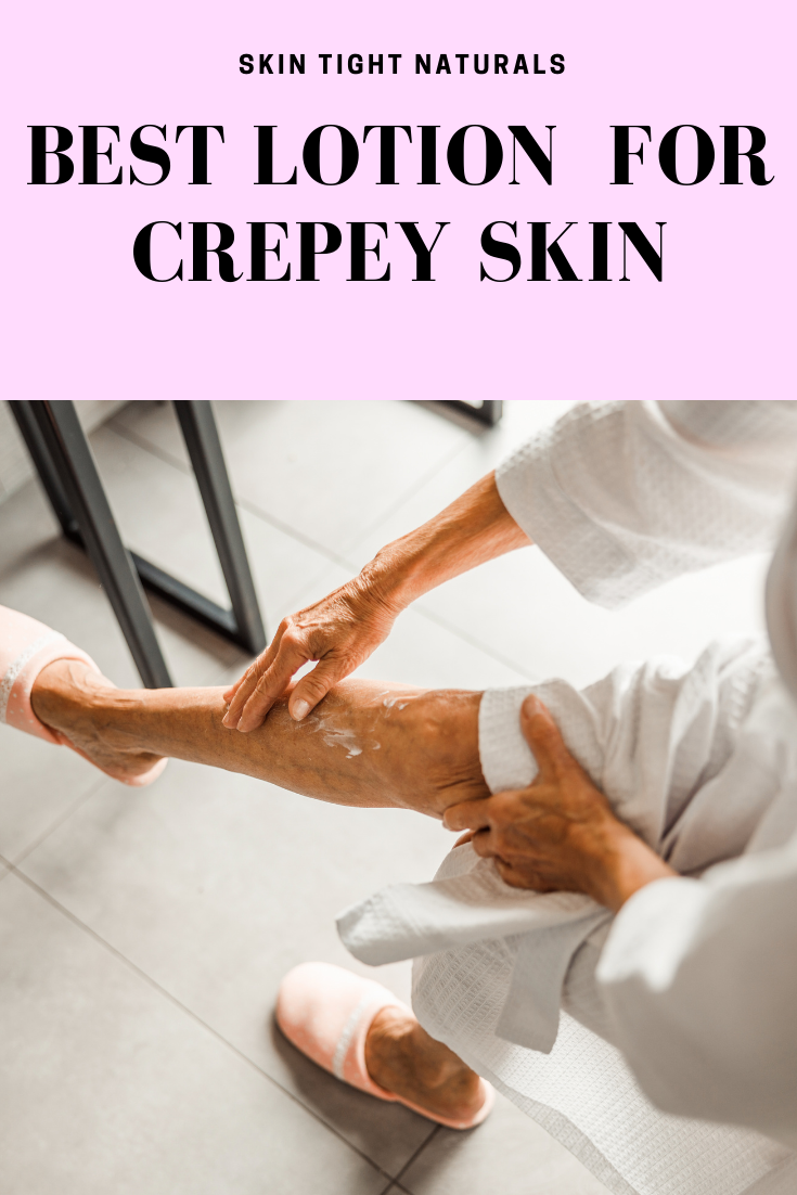 Best Lotion For Crepey Skin