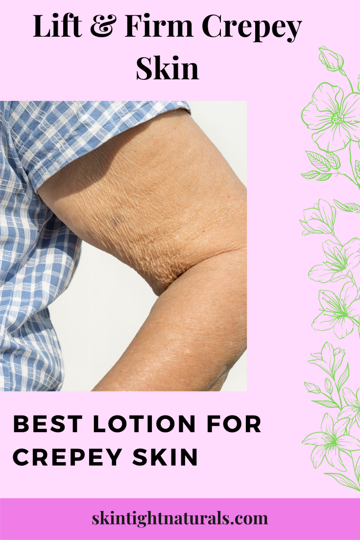 Best Lotion For Crepey Skin