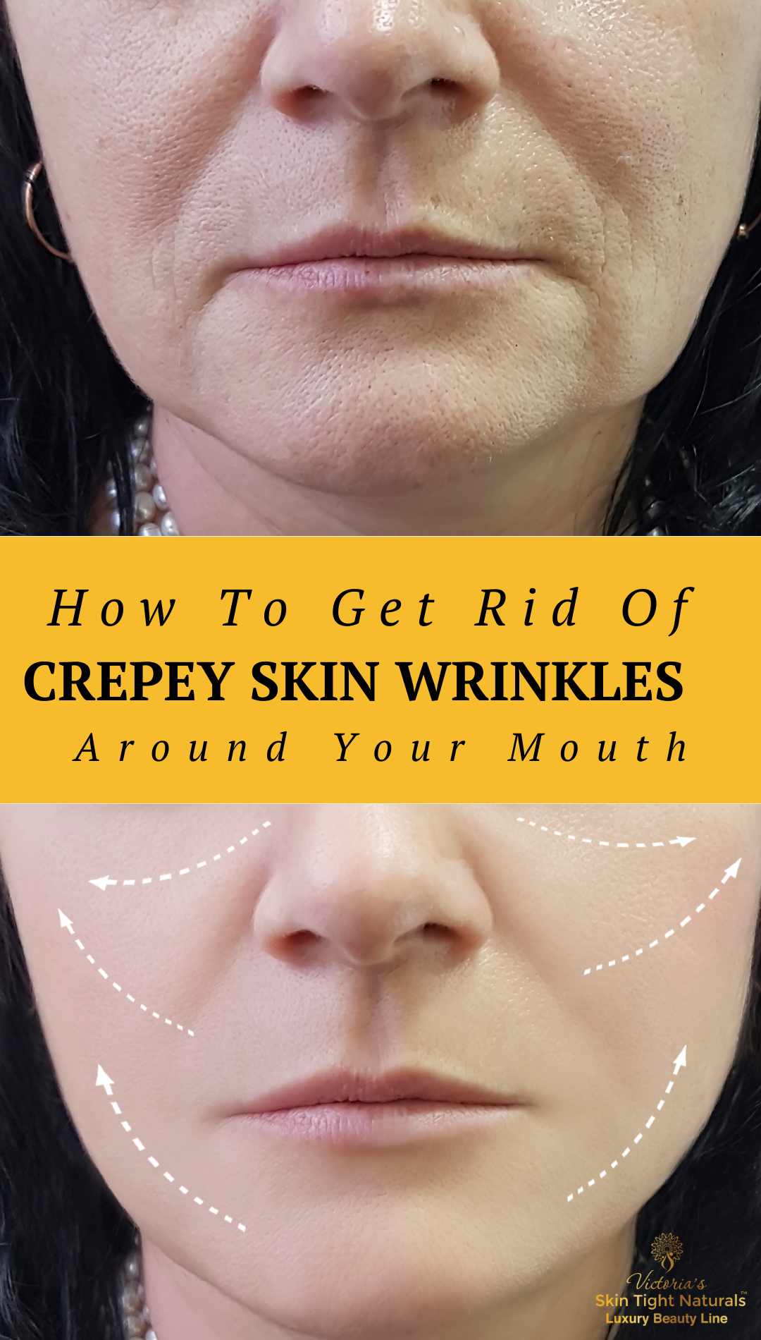 How To Fix Crepey Skin Naturally